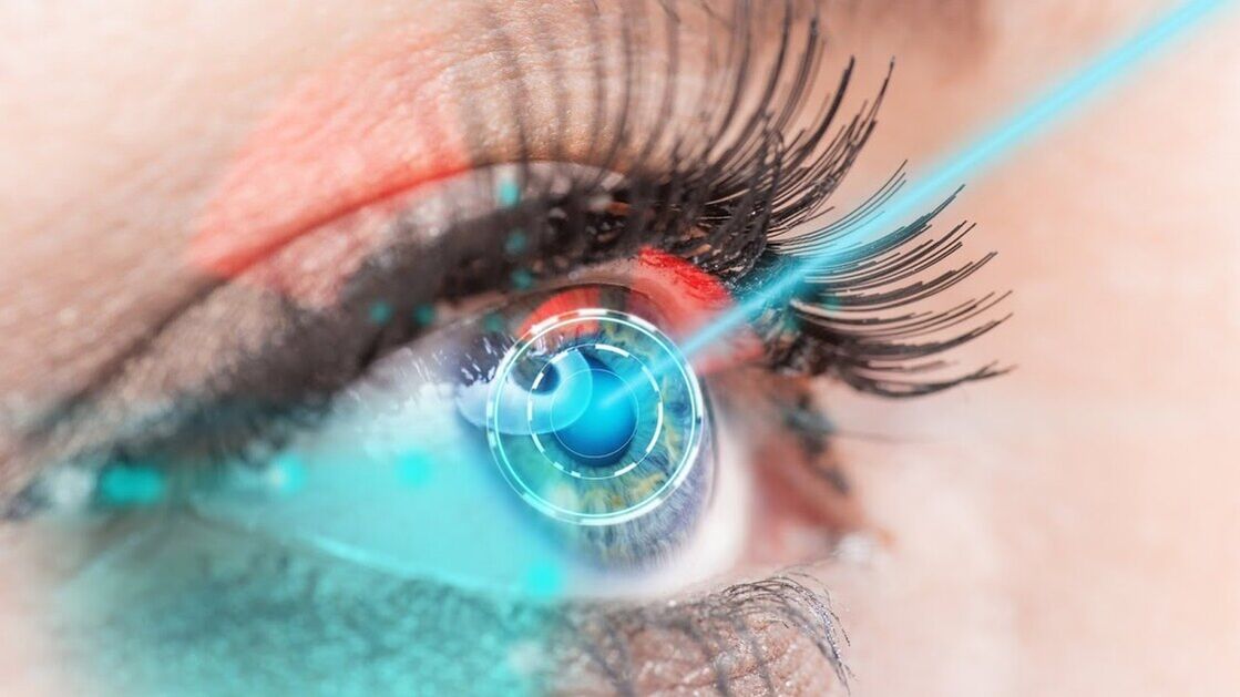 Restoring vision using laser correction